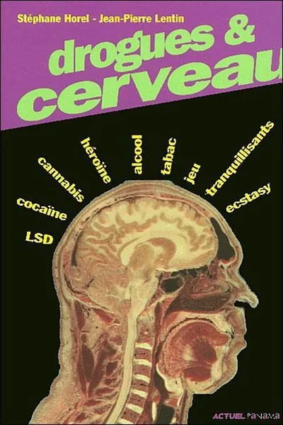 Drogues et cerveau poster